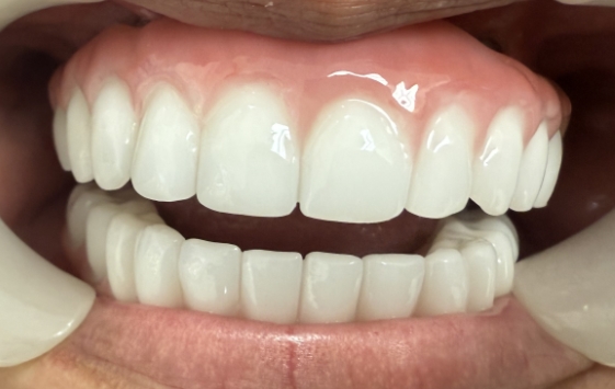 Close up of a mouth with evenly aligned teeth