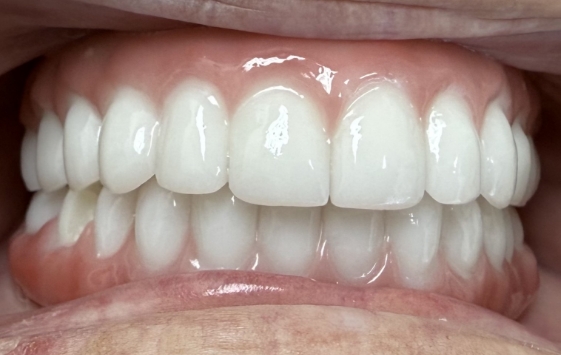 Close up of a mouth with evenly aligned teeth