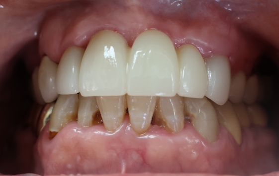 Close up of a mouth with slightly gapped teeth