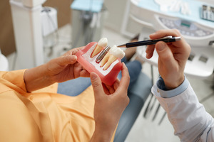 Dentist showing model of dental implant to patient